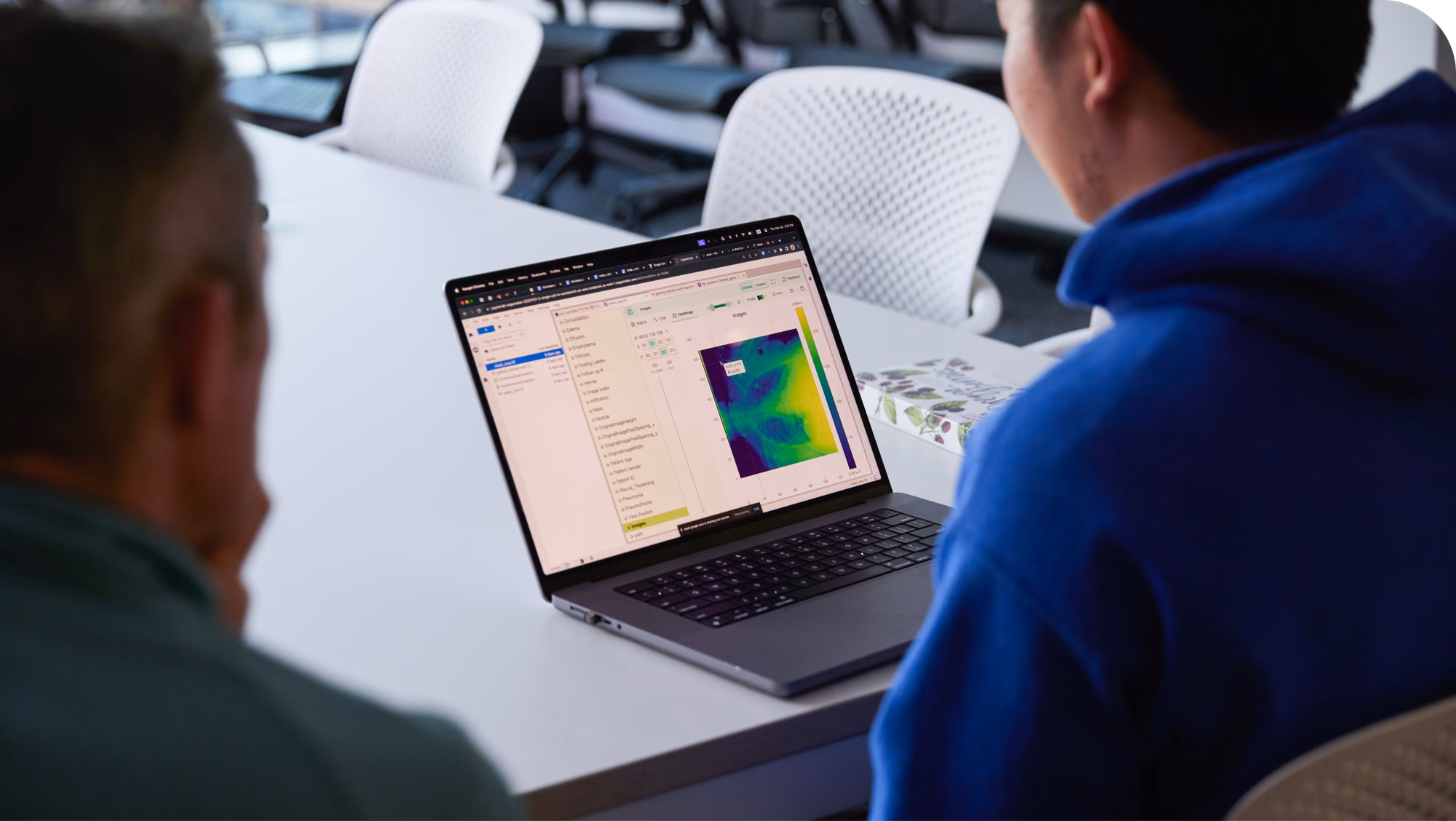 Two people seated at a conference table looking at a laptop screen displaying medical imaging software.